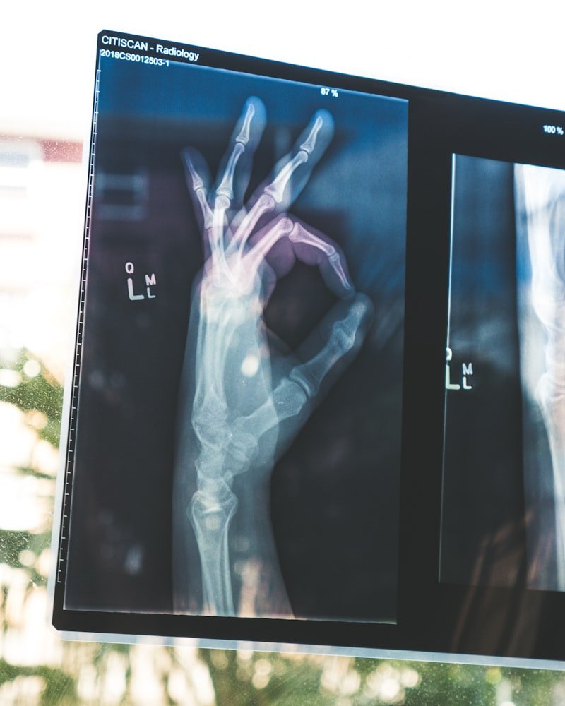 Free Mega Orthopedic & Joint Pain Health Camp Announced
